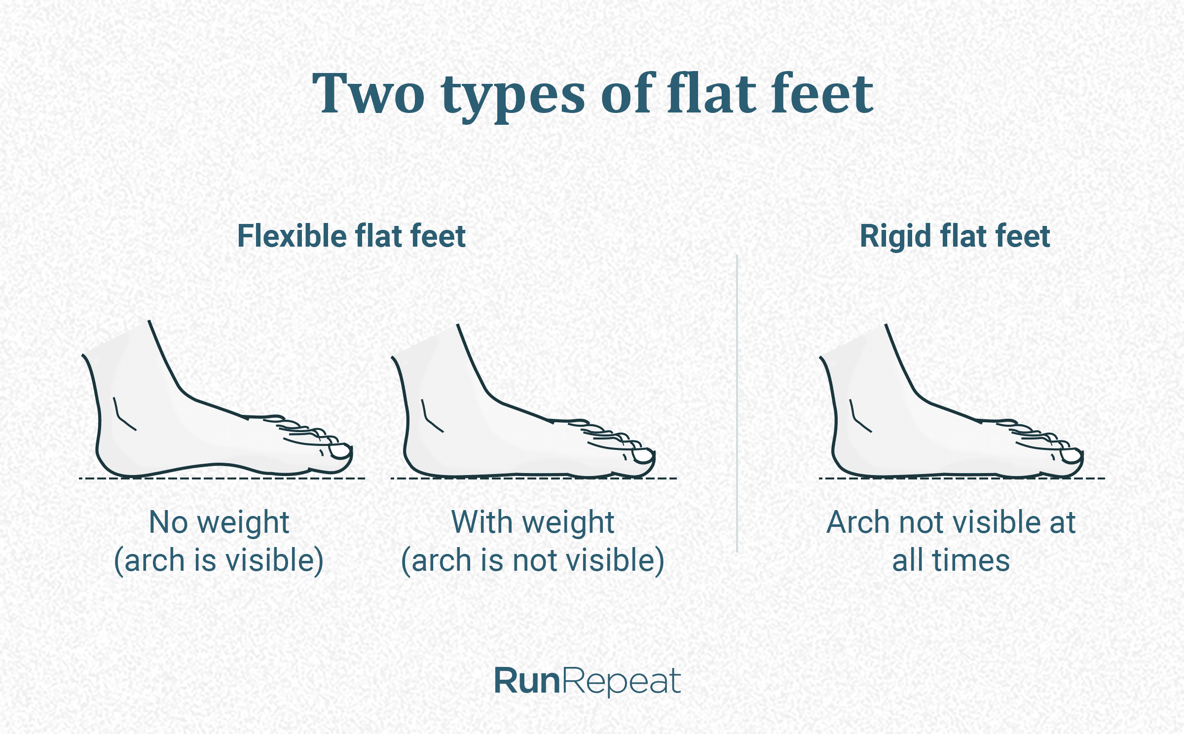 Shoe type clearance for flat feet